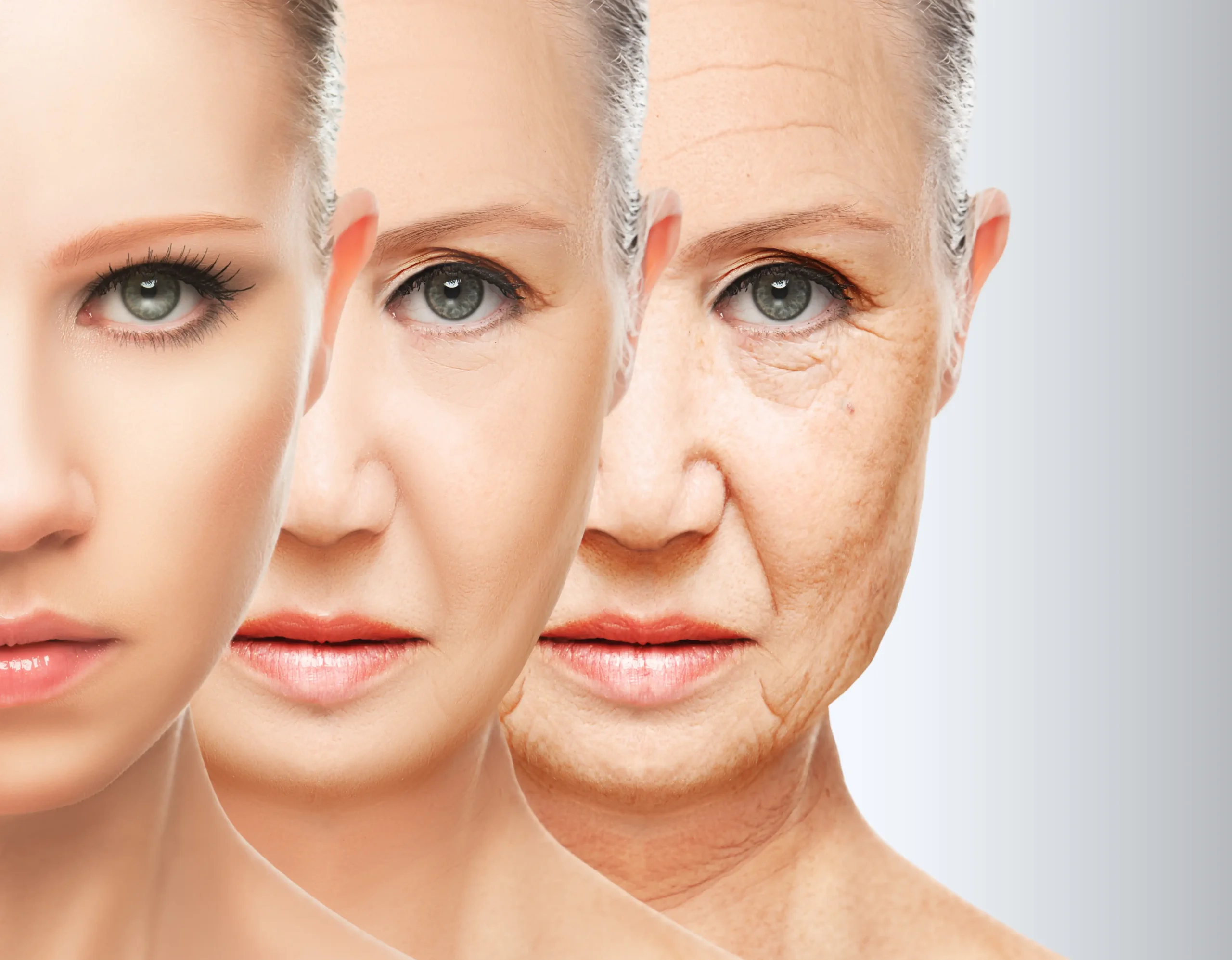 Fotona 4D vs Traditional Facelifts – What’s Right for You