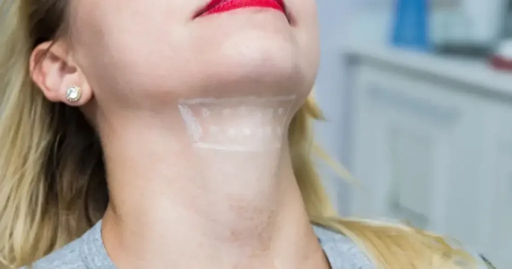 Neck Rejuvenation Guide: The Best Non-Surgical Treatments Compared