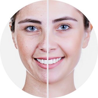 Anti-Aging Skincare in Costa Mesa & Orange County, CA