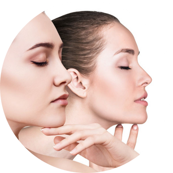 VI Peels I Skin tag removal