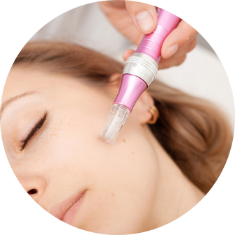 Microneedling