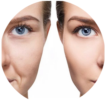 a close up of a woman's face with VIPeel in Costa Mesa, CA