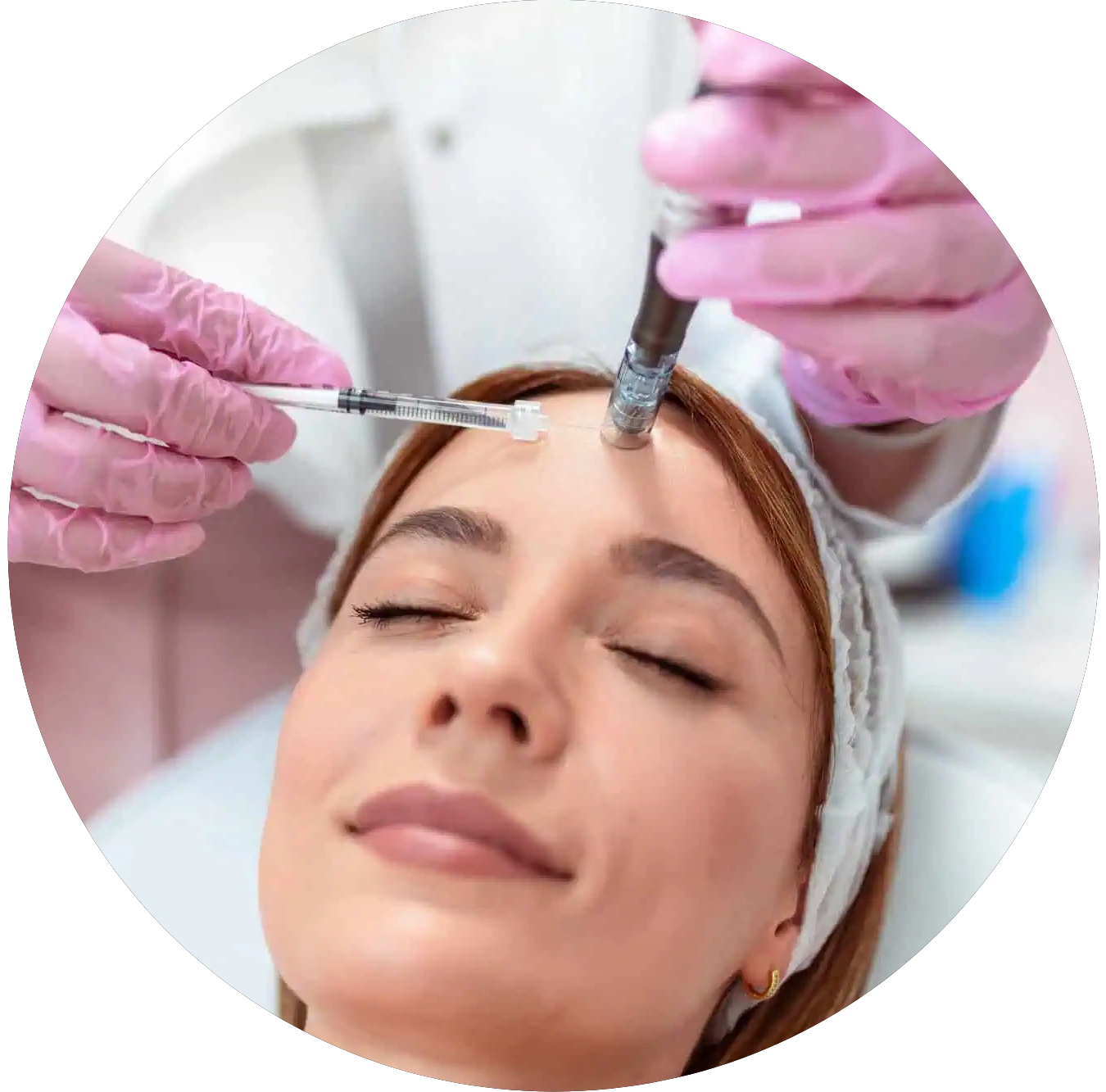 Microneedling with PRF