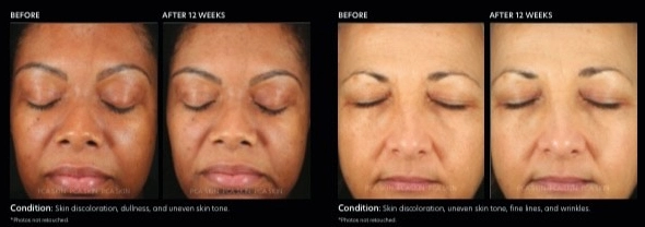 a comparison of a woman's face