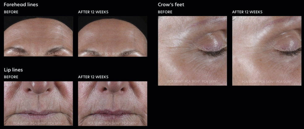 close-up of a person's face