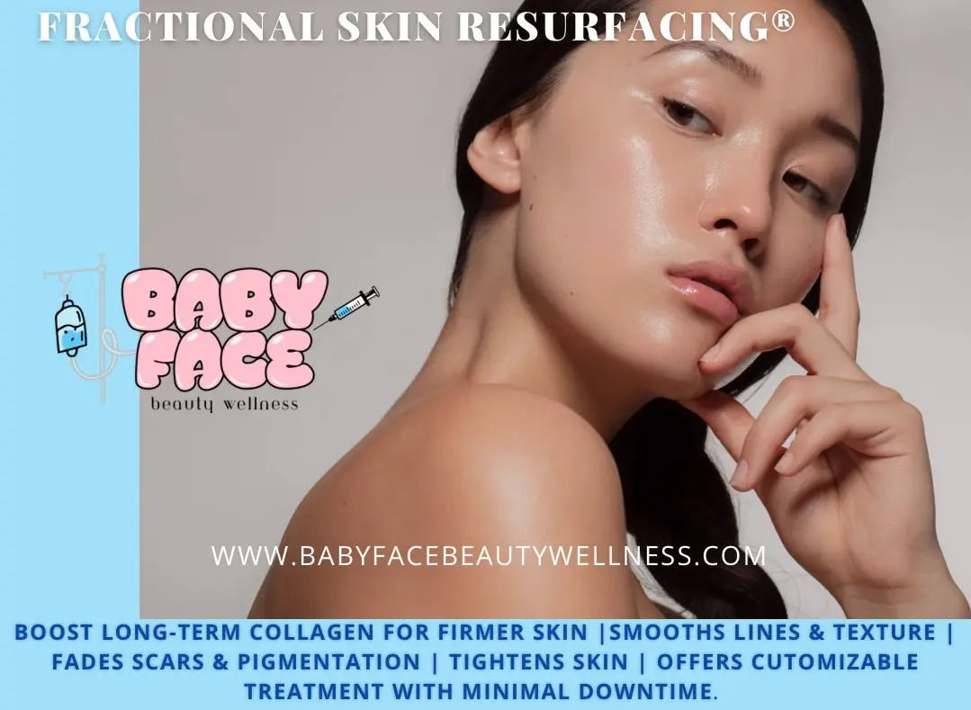 Fotona Fractional Laser Skin Resurfacing in Costa Mesa, CA