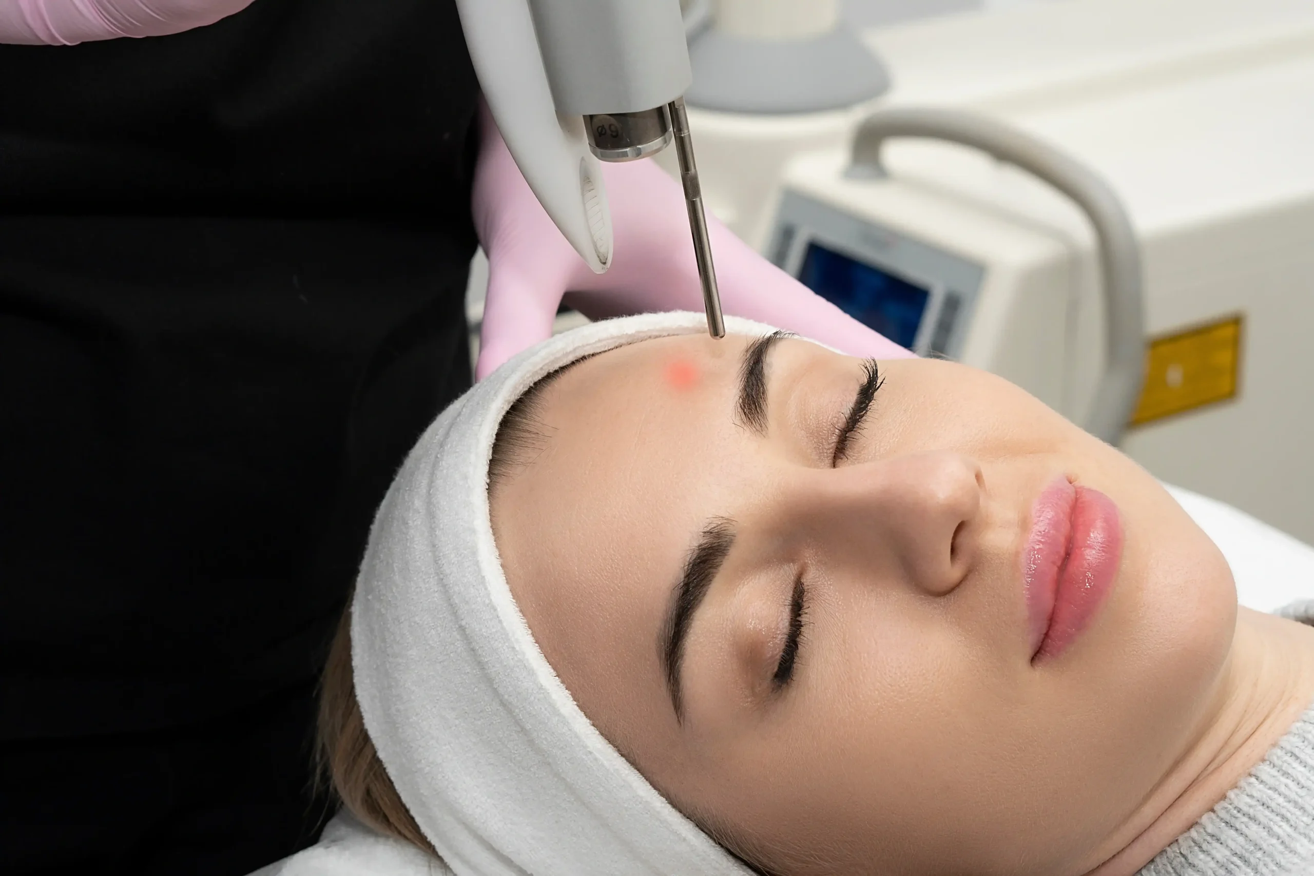 Fotona Skin Resurfacing in Costa Mesa, CA