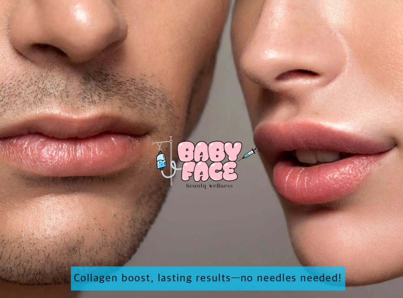 Fotona Liplase for Lip Enhancement