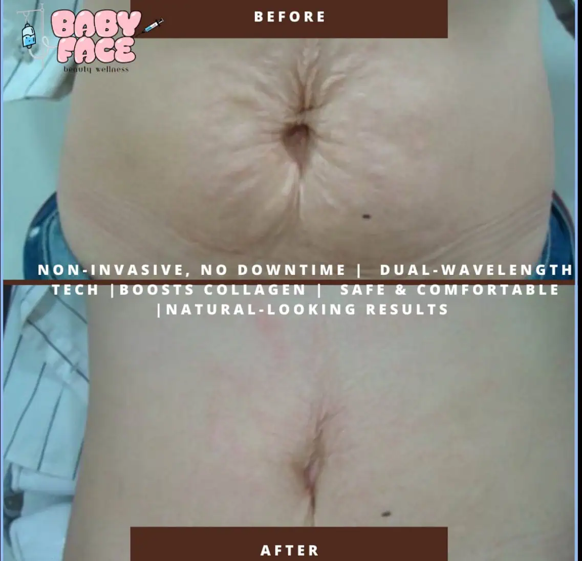 a close up of a woman's belly