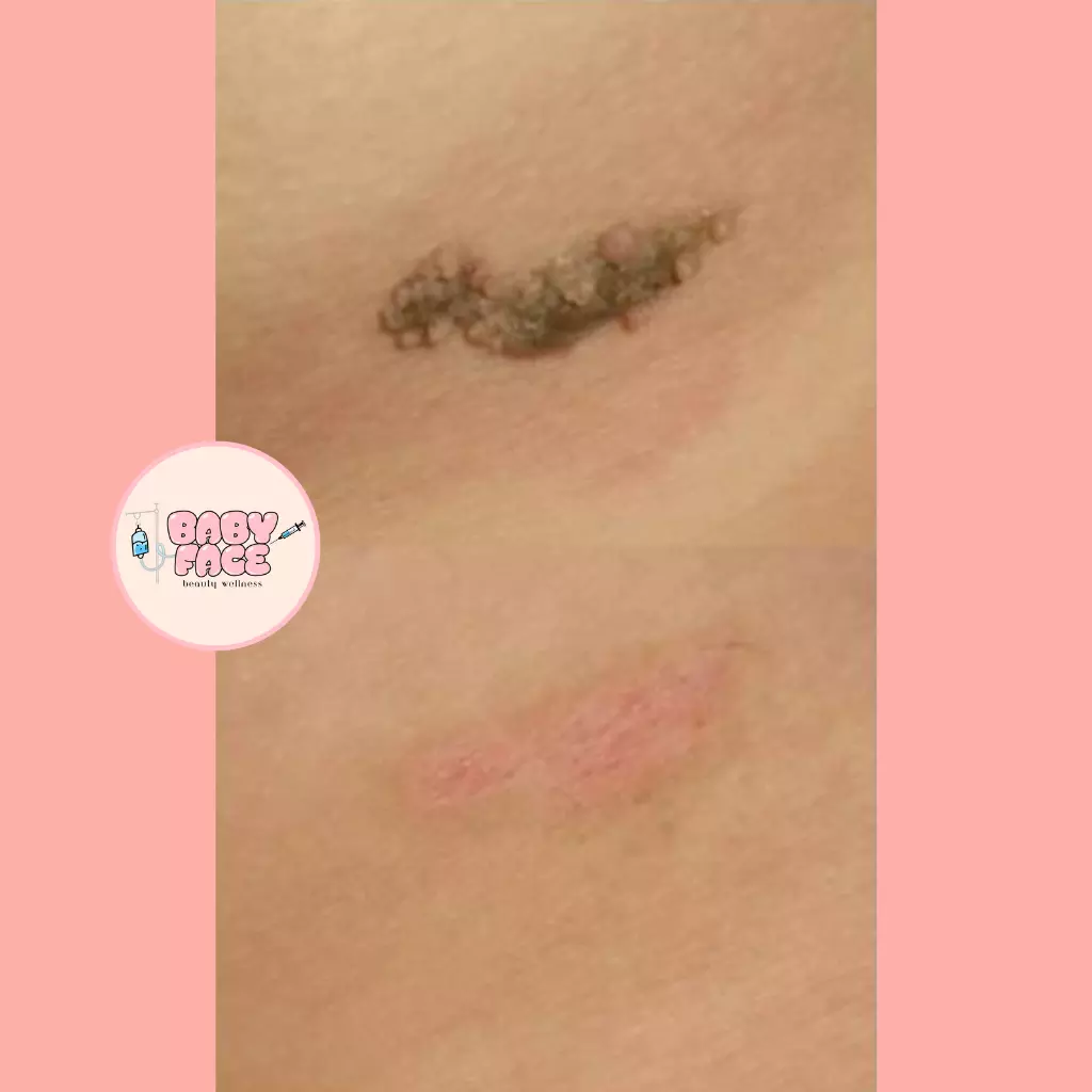 a close up of a skin