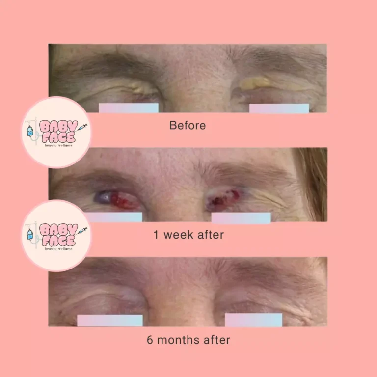 a collage of a person's eyes