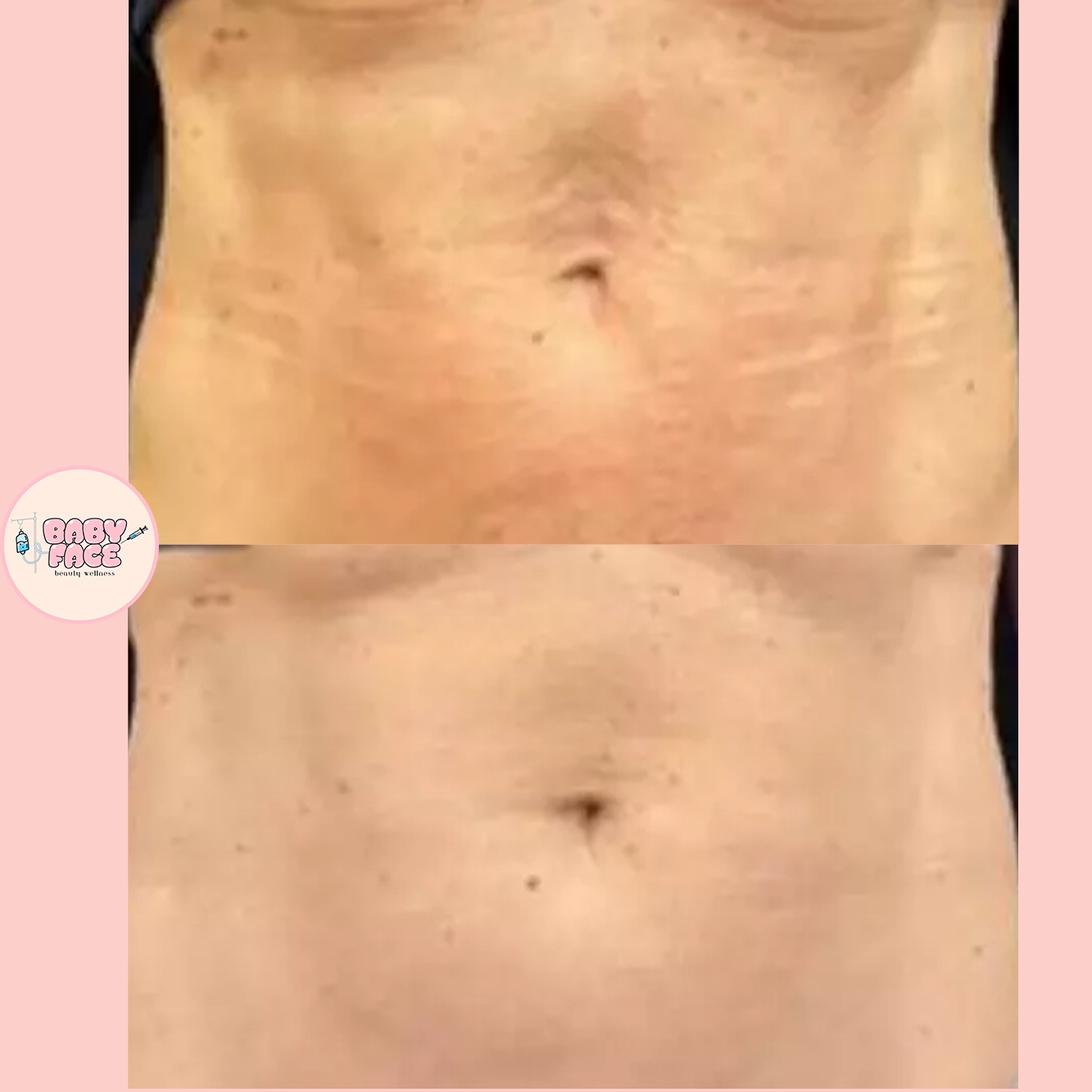 a close up of a woman's belly