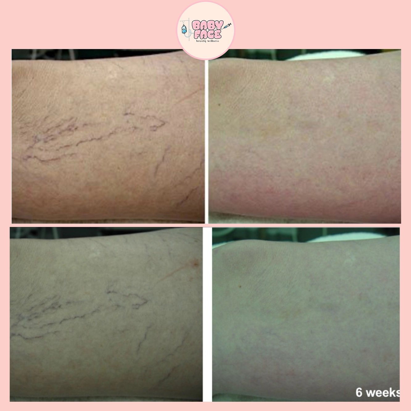 a collage of different skin types