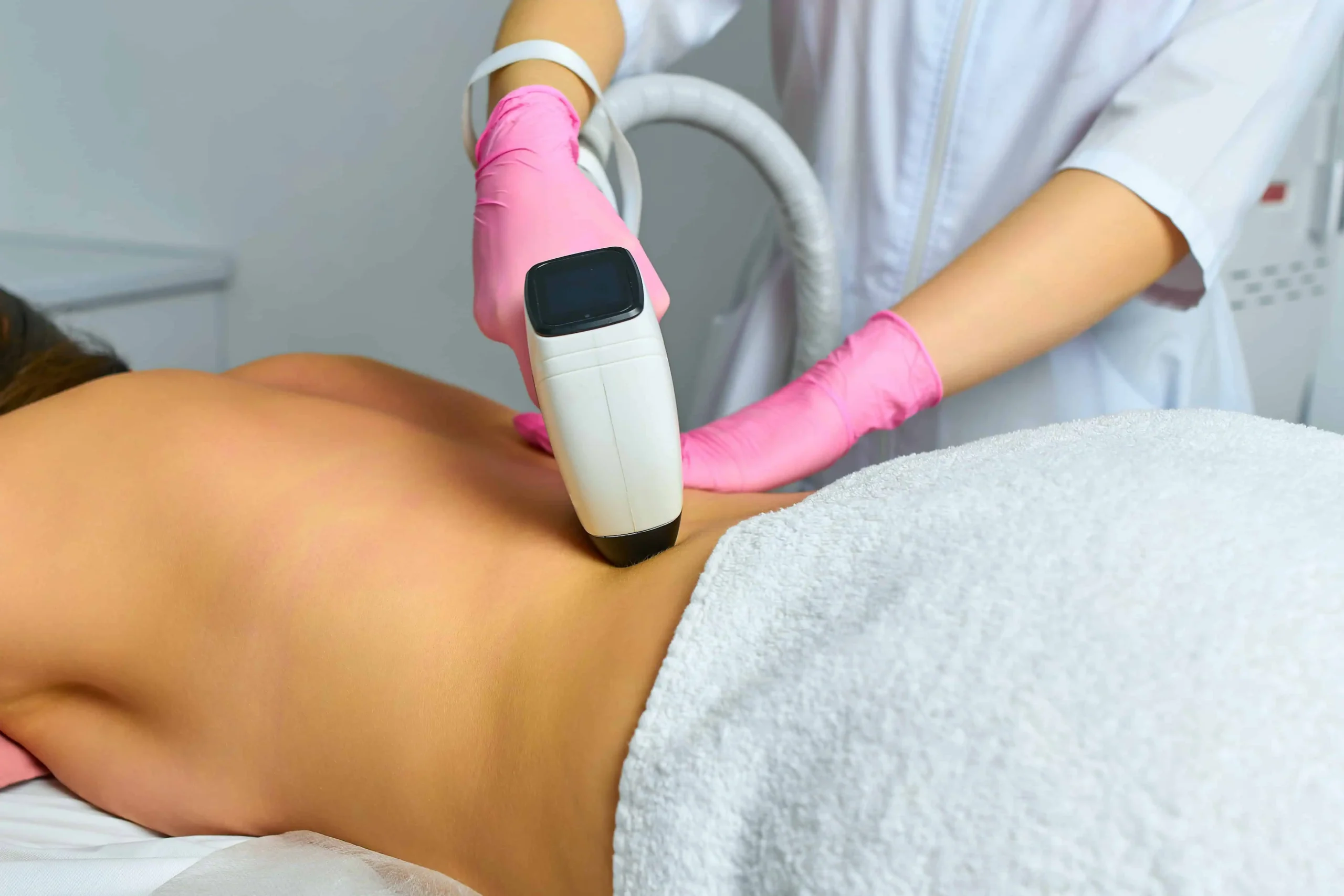 a person receiving Back Laser Hair Removal in Costa Mesa, CA