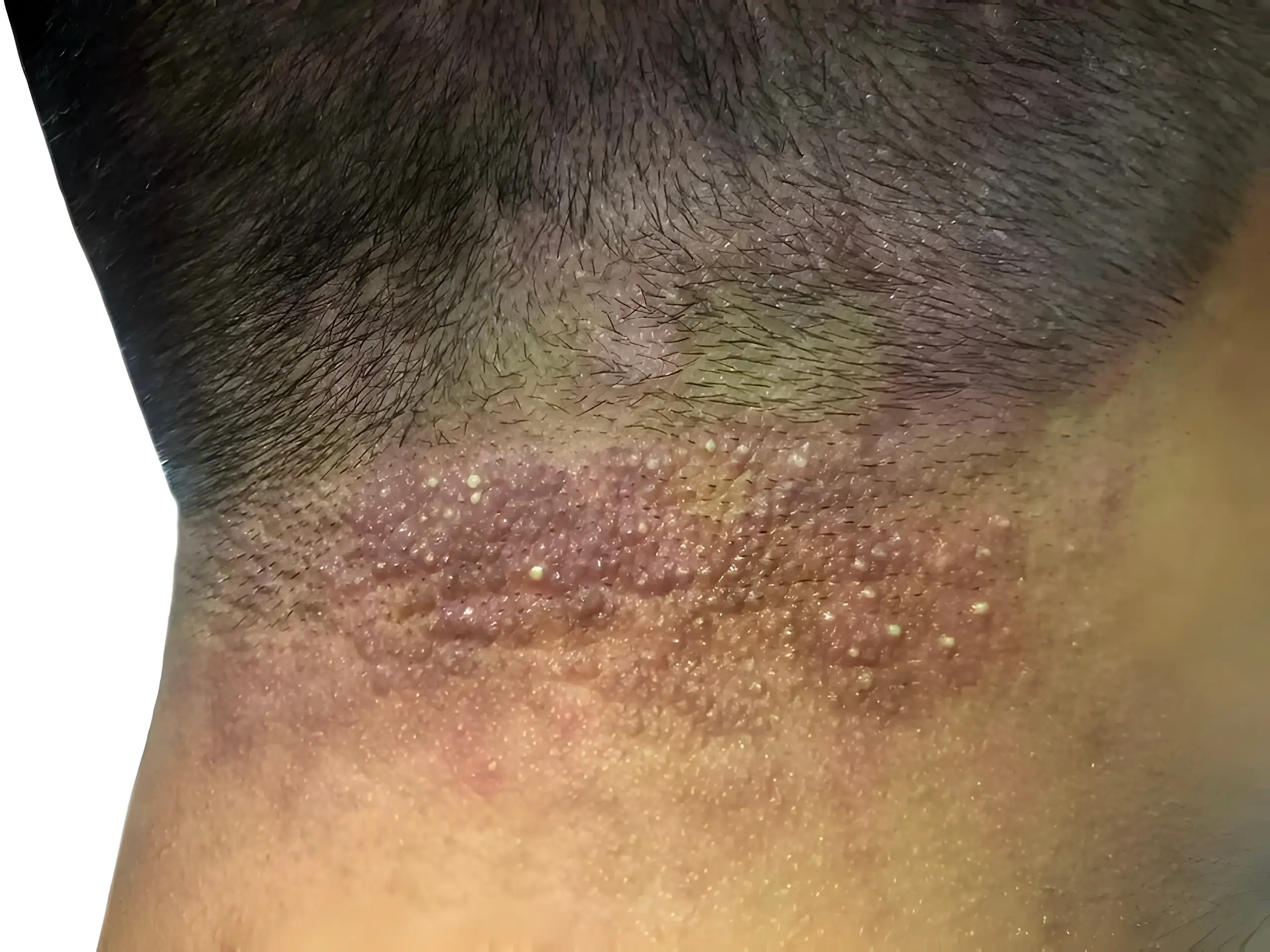 a close up of a person's neck